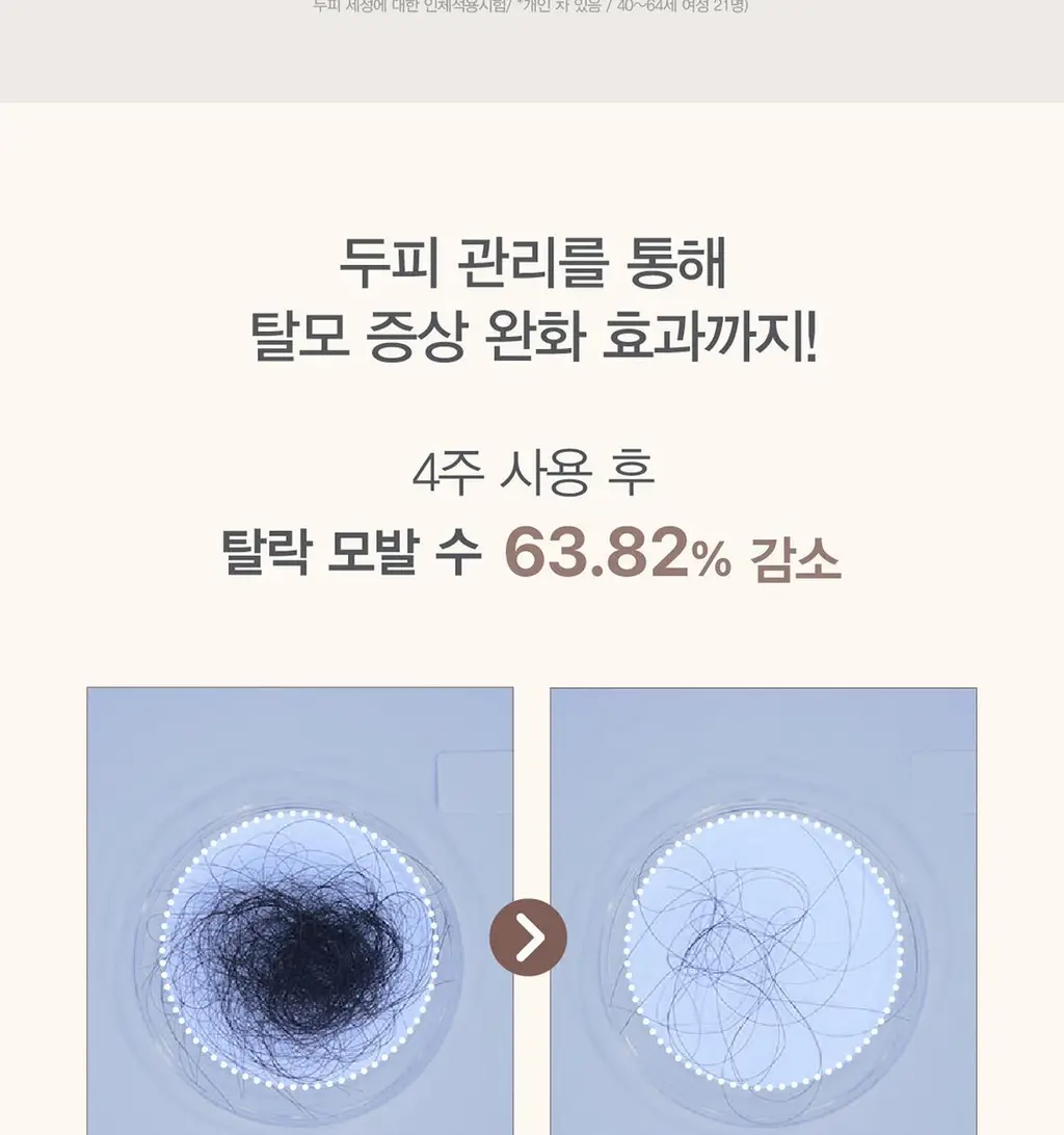 [탈모증상완화/식초샴푸] 원오세븐 스칼프 퓨리파잉 마이크로바이옴 샴푸 380ml 상세페이지 8